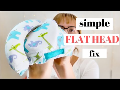 It was SO SIMPLE! | How we fixed my baby's FLAT HEAD and avoided the HELMET | Flat head fix