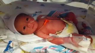 Preemie twin 30 weeks, 5 days... Baby Henry, SO ALERT!! 1 day old..