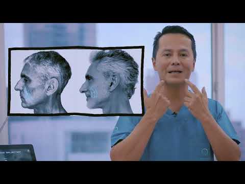 ¿Qué cirugía le realizamos a Miguel Varoni? #facelift #alangonzalez