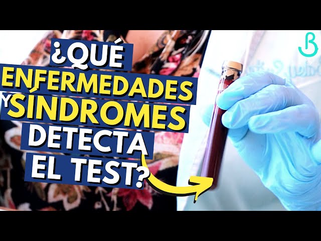 Vídeo relacionado con Probador de progesterona portátil con 50 tarjetas de reactivos. Determina con precisión el tiempo de apareamiento óptimo para perros, pruebas automáticas y visualización de resultados
