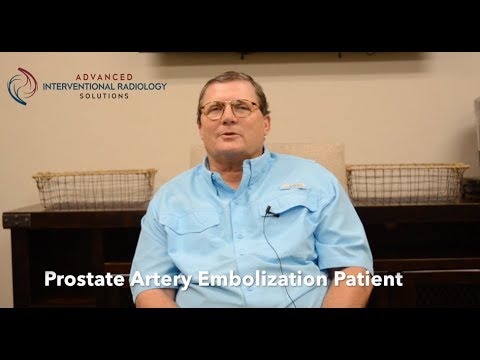 Prostate Artery Embolization (PAE) Patient Testimonial