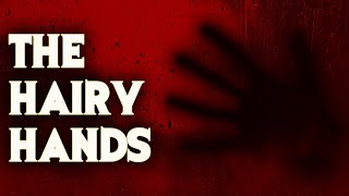 Download lagu The Terrifying Hairy Hands Of Dartmoor mp3 Download lagu The Terrifying Hairy Hands Of Dartmoor mp3