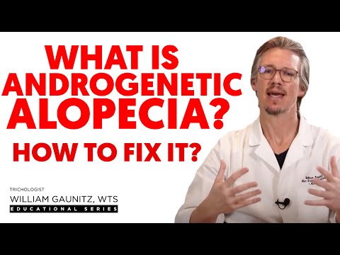 Androgenic Alopecia: What Is It & What To Do About It (Solution For Hair Baldness)