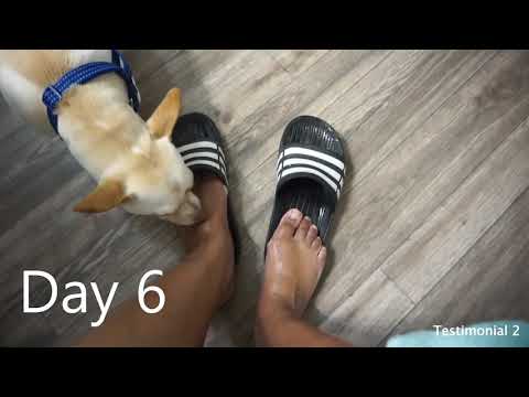 Peel-feet™ foot mask testimonials