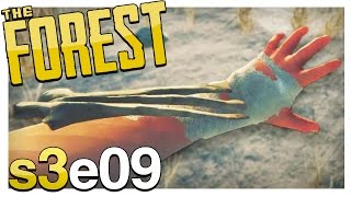 UPDATE! BONE ARMOR, TOUGHER MUTANTS + POISON ARROW NERF | The Forest Gameplay S3E09 (Alpha v0.33)