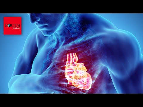 „Sekundentod“ trifft auch junge Menschen - Das sind die Warnsignale