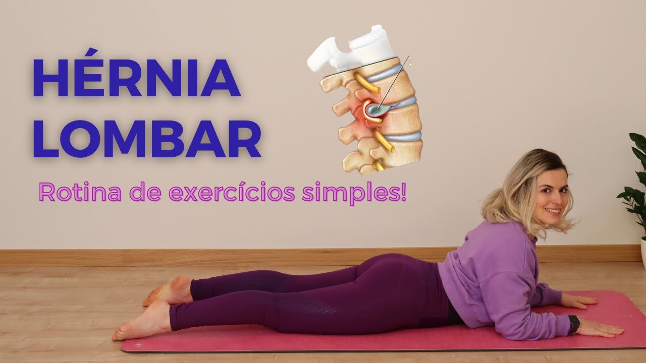 Exercícios para HÉRNIA DE DISCO - Movimento é seu medicamento
