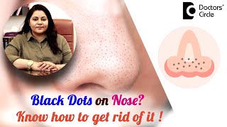 Black Dots on the Nose? Know how to treat them ! #blackhead  - Dr.Tina Ramachander | Doctors