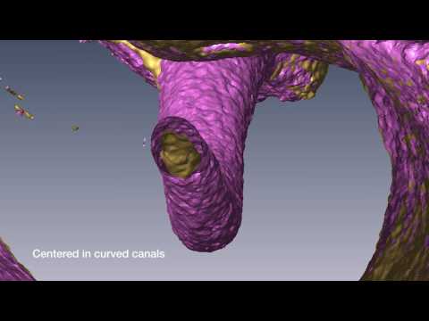 VDW Dental · Grande & Plotino: RECIPROC centering ability in curved canals (clinical video)