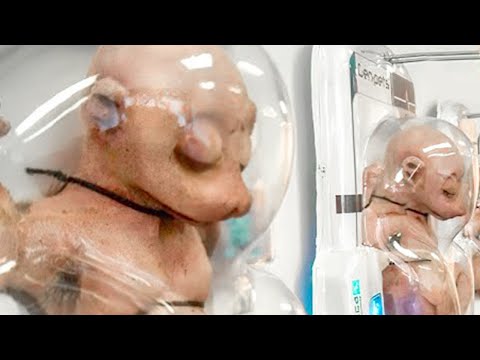 FERMERI ZBULON DICKA MISTERIOZE NE TOKAT E TIJ ...