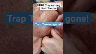 HUGE TRAP MASSAGE FOR NECK TENSION! #massage #sportmassage #painrehab #backpainrelief #sportsmassage