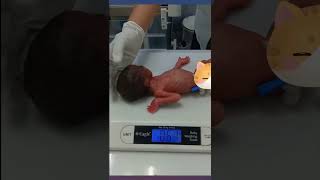 Amazingly tiny but stable preterm baby! ❤️