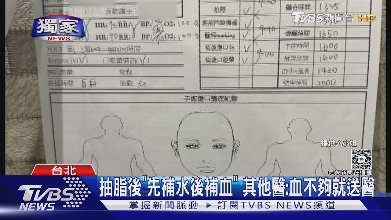 昏厥+腿痛 女控抽脂險「腎衰竭」醫師駁斥