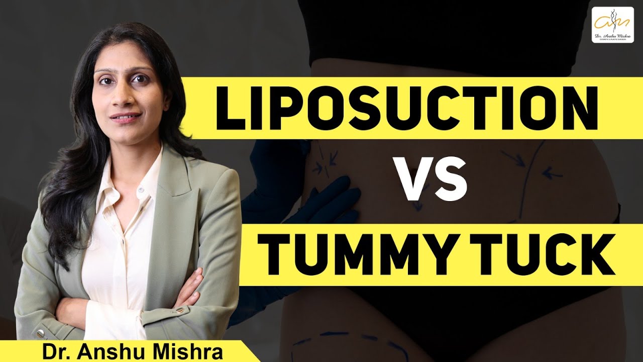 Liposuction vs. Tummy Tuck - Which Body Contouring Option Is Right for You? | Dr. Anshu Mishra