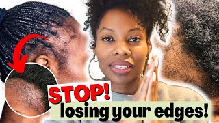 Grow Your EDGES BACK! Fast Thicker With This Regimen - How To Treat Traction Alopecia!