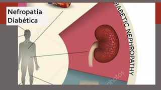 Complicaciones de la diabetes