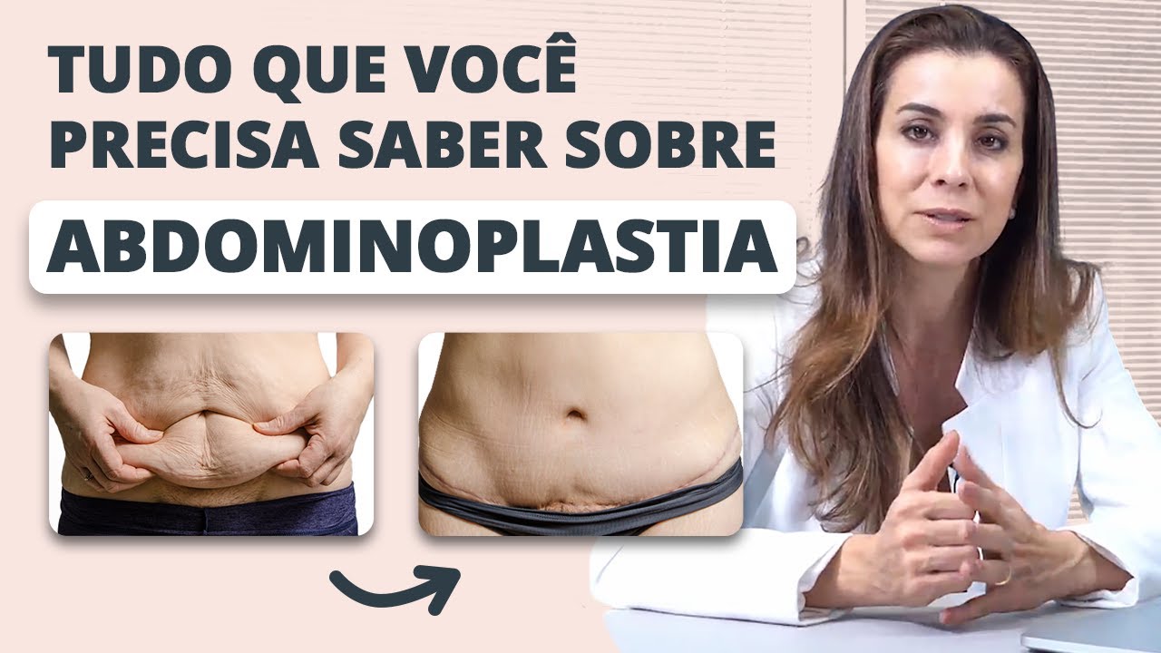 Abdominoplastia: Tudo que você precisa saber antes de operar!