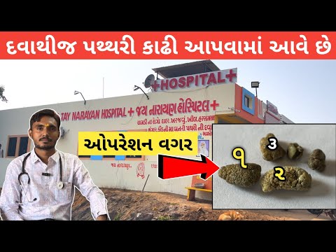 દવા માત્ર થીજ પથરી નીકળી જાય છે