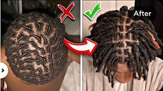 How to Avoid The UGLY Stage of Dreadlocks