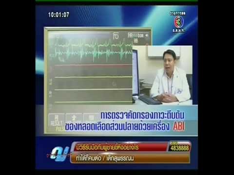 การเยียวยาชาวบ้านกลากรักษา Excimer เลเซอร์สำหรับโรคสะเก็ดเงิน