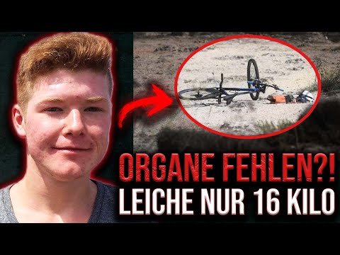 Organe fehlen?! Gewicht nur noch 16 Kilogramm | Der Fall Mike Mansholt