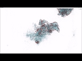 E Coli Bacteria Lysis Caused By Bacteriophage T4
