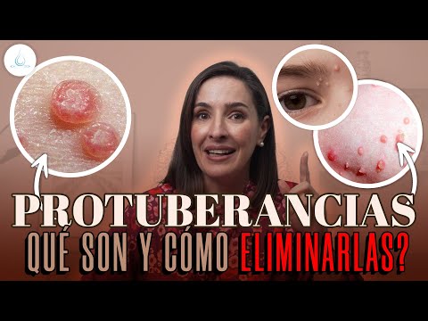 🔴 ¡CUIDADO! SI Tienes MOLUSCOS CONTAGIOSOS podrias Tener una GRAVE ENFERMEDAD  @drapilarochoa