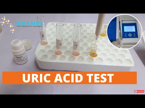 image-How is uric acid measured?