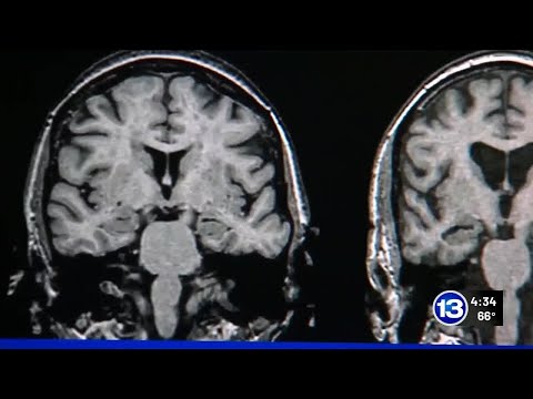 13 Action News Big Story: Dementia Research