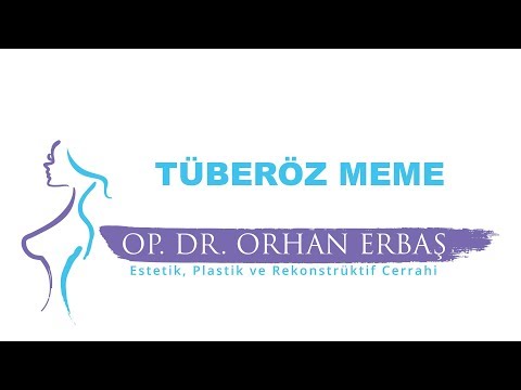 Tüberöz Meme