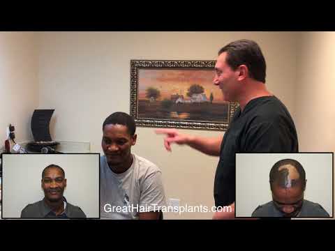 Ron Burn Patient Hair Restoration