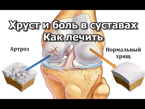Лечебные упражнения при шейной грыже позвоночника Узи тазобедренных суставов в новосибирске