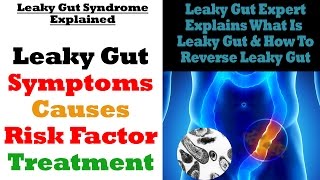 Leaky Gut Syndrome: Causes, Symptoms, Risk Factors & How To Reverse Leaky Gut