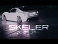 Bones Change Of Scenery Skeler Remix