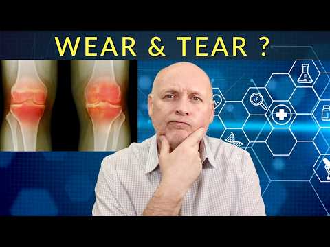 Will Exercise Help Osteoarthritis ? Is it Really a Wear & Tear Condition ?