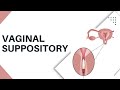 Vaginal Suppository Insertion - How to put It Safely and Easily
