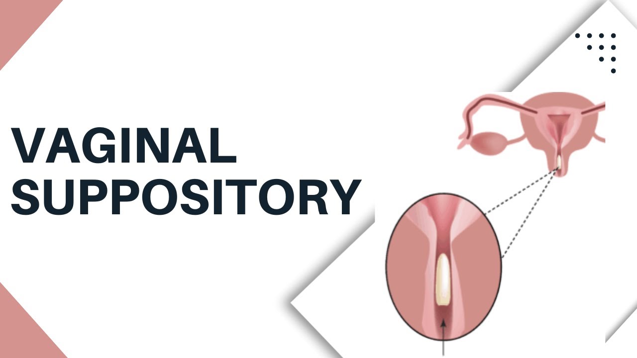 Vaginal Suppository Insertion - How to put It Safely and Easily