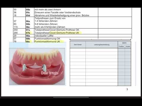 Coverdenture-Prothesen oder Deckprothesen - HKP abrechnen 4/4