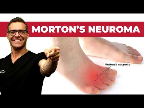 How To Treat Morton s Neuroma Foot Injection Research 2021