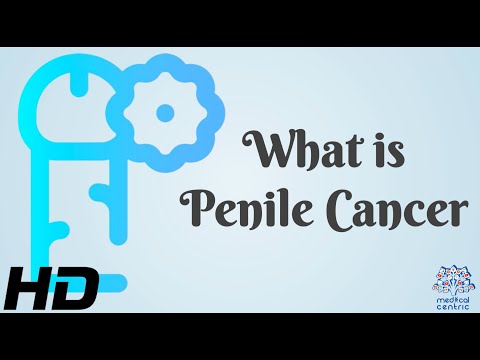 Effects of Cannabis on your body