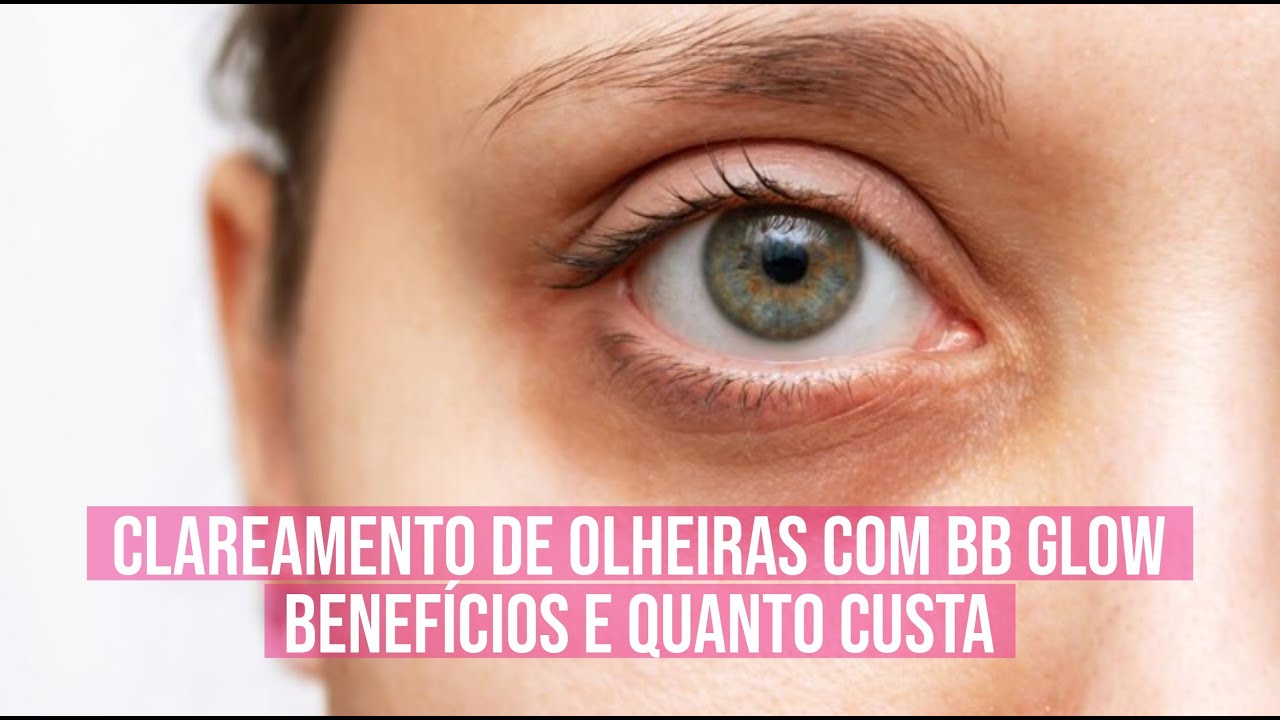 Clareamento de Olheiras com BB Glow, Benefícios e Quanto Custa