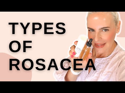 Esthetician’s Guide to Rosacea | Part 1 | Types of Rosacea