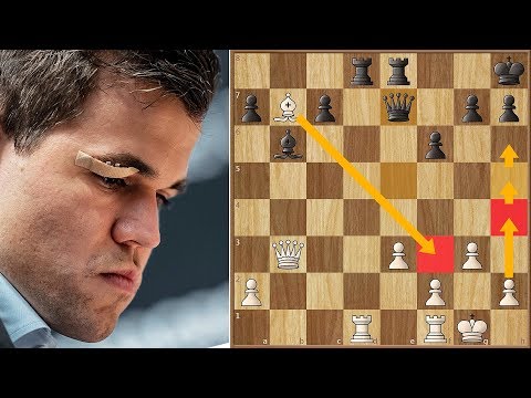 Throwing Punches | Carlsen vs Caruana 2018. | Game 9