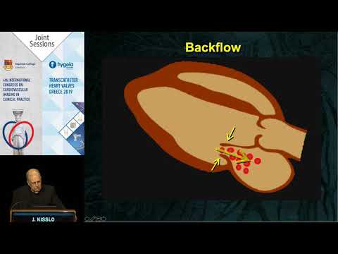 J. Kisslo  | Defining Secondary Mitral Regurgitation: Get it Right!
