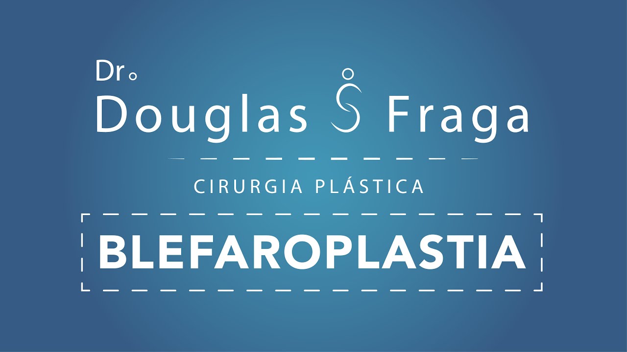 Douglas Severo Fraga-12