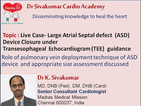 3/12 Large Atrial Septal defect  (ASD) Device Closure under Transesophageal  Echo  guidance