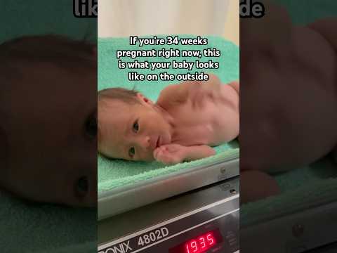 She was 2kg measuring 34weeks born at 37weeks #iugr #preemie #smallbaby #nicu #newborn #babyshorts