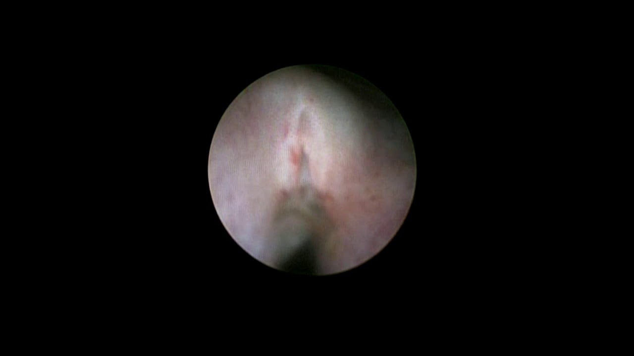 Rene Carmona Barba-14