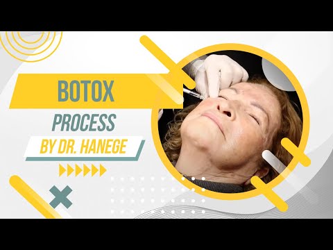 How do We do Botox?