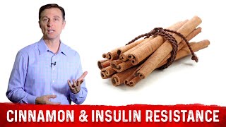 Download lagu Cinnamon Benefits for Insulin Resistance & Diabetes – Dr. Berg mp3